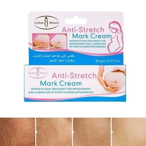 anti stretch mark cream (60gm)